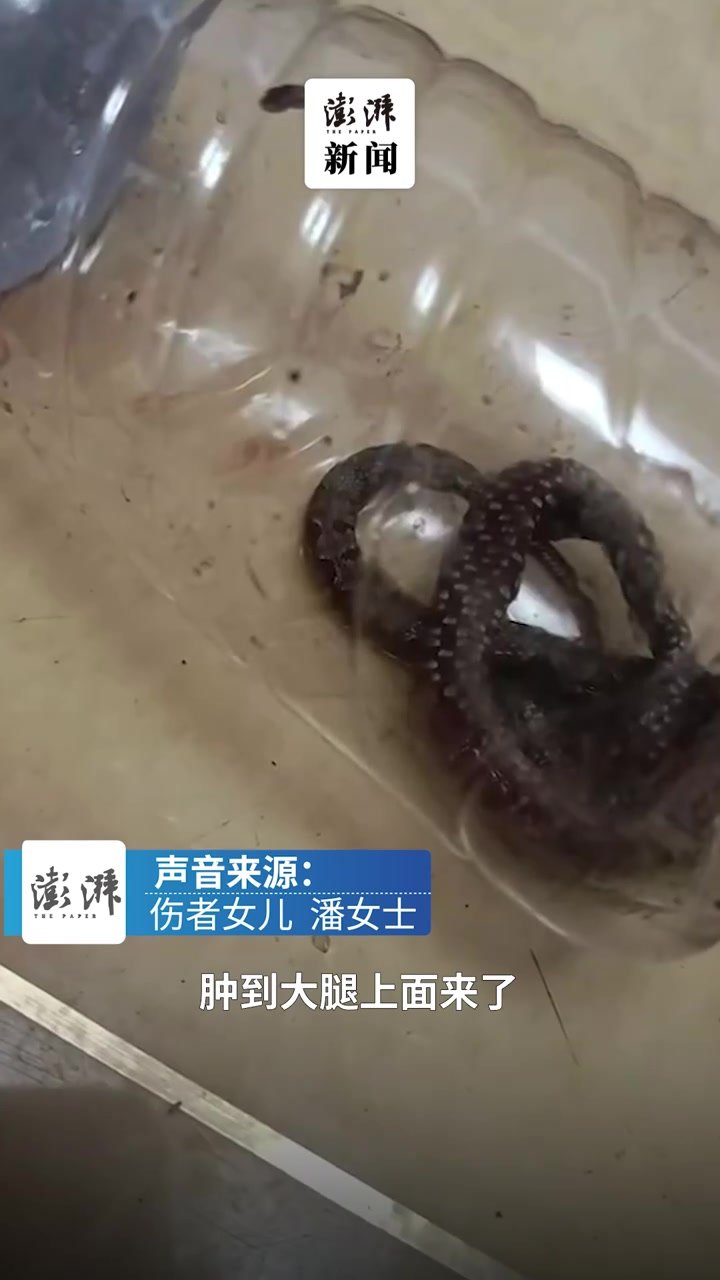 女子吐槽小猫叼回毒蛇咬伤家人:脚已恢复知觉,仍在医院观察_凤凰网视频_凤凰网