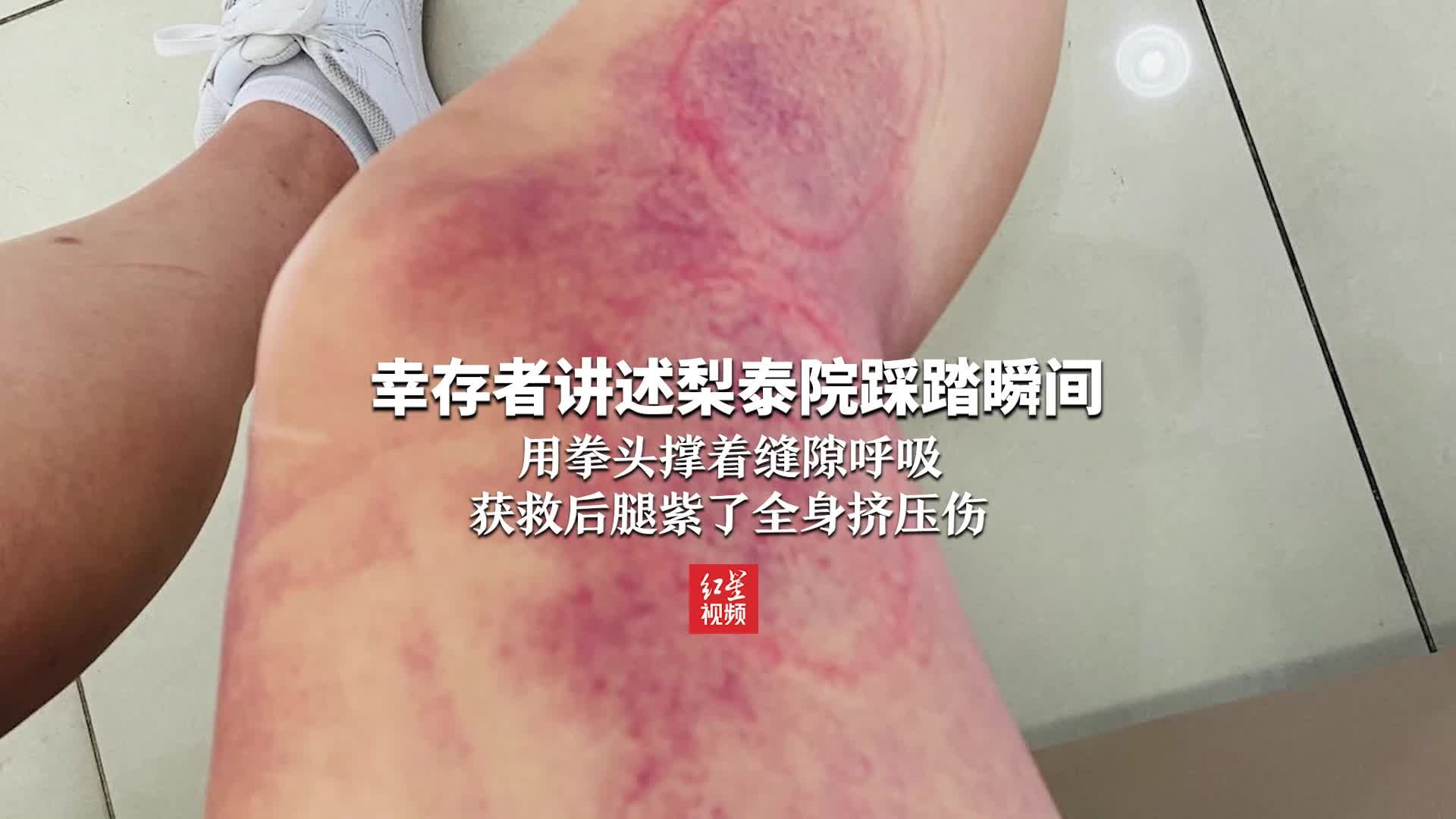 幸存者讲述梨泰院踩踏瞬间：用拳头撑着缝隙呼吸 获救后腿紫了全身挤压伤