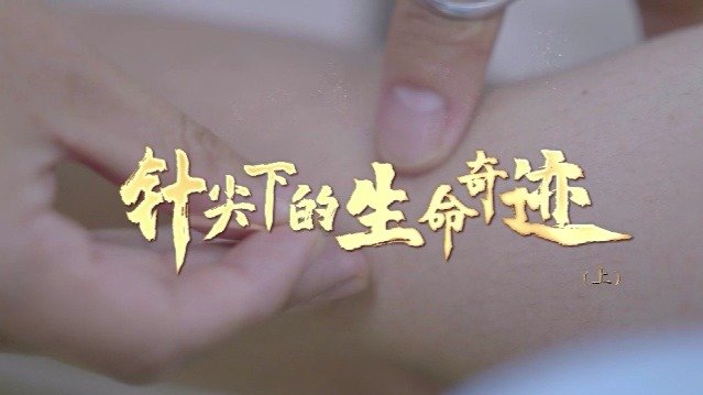 外科医生为何把针灸带入手术室？新疆女孩的这封信打动了他