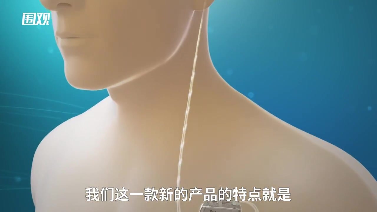 进博会｜波士顿科学五款创新产品亮相进博，守护患者的脑健康