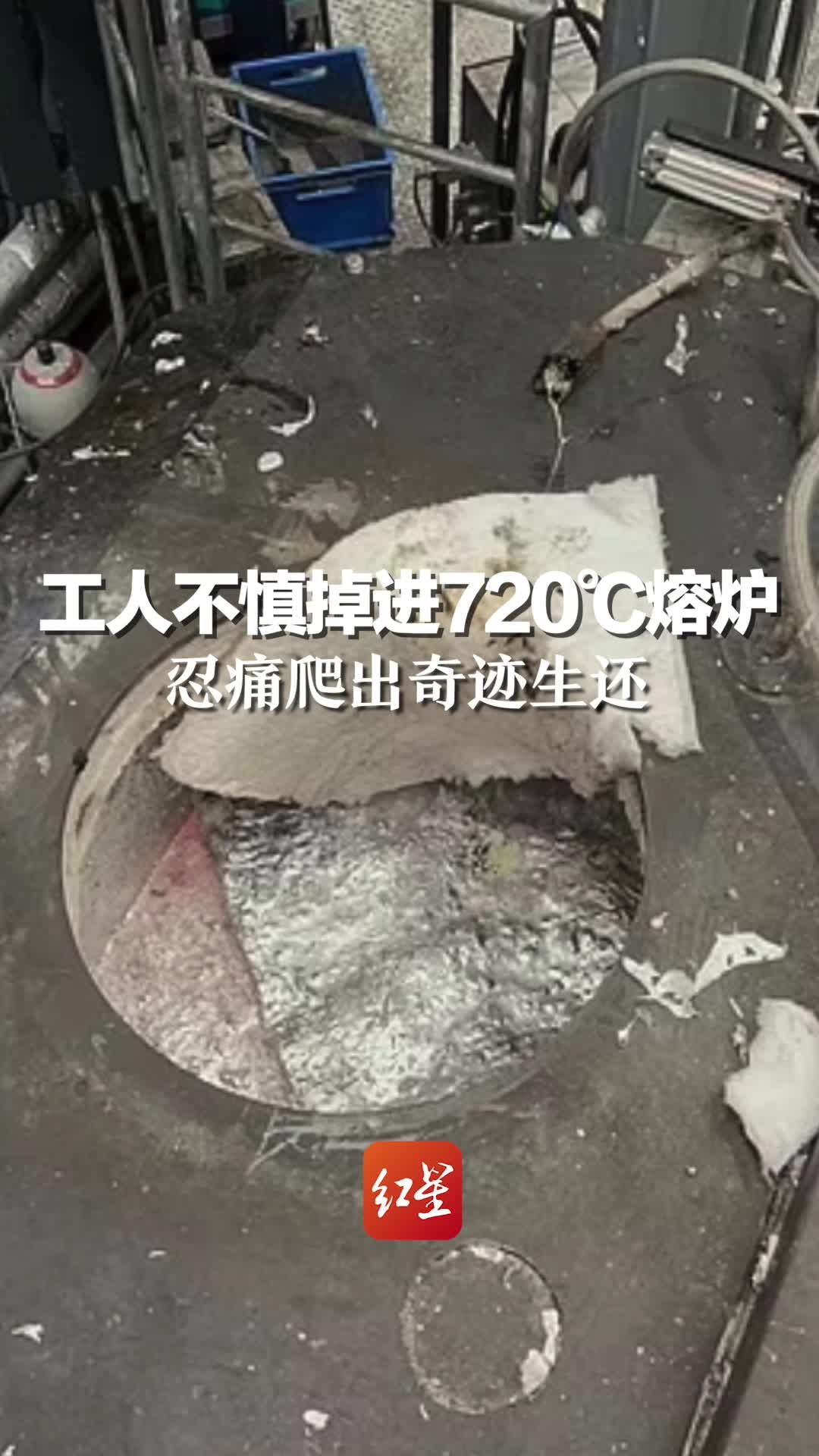 瑞士工人不慎掉进720℃熔炉：双腿浸在沸腾溶液，忍痛爬出奇迹生还