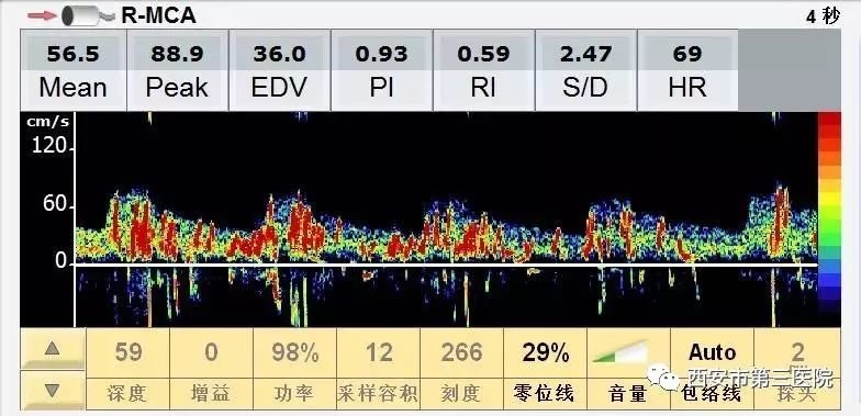 【活动预告】CACA攻略我国行-“术造巅峰”外科才能进步行将举办
