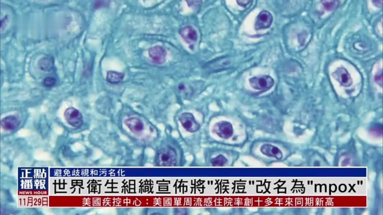 世界卫生组织宣布将“猴痘”改名为“mpox”