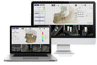 医疗设备有哪些机器雅客智慧种牙机器人，助力政府贴息医疗设备更新改造项目 好消息！_https://www.jmylbn.com_新闻资讯_第4张