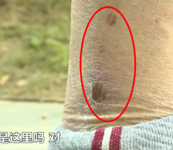 长沙68岁保洁员被小狗“咬”伤 狗主人却称:要赔得证明你被咬了凤凰网湖南_凤凰网