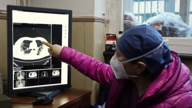 12月24日,北京中医医院重症医学科宋麦芬主任正在查看新冠患者肺部CT片。曹子豪摄