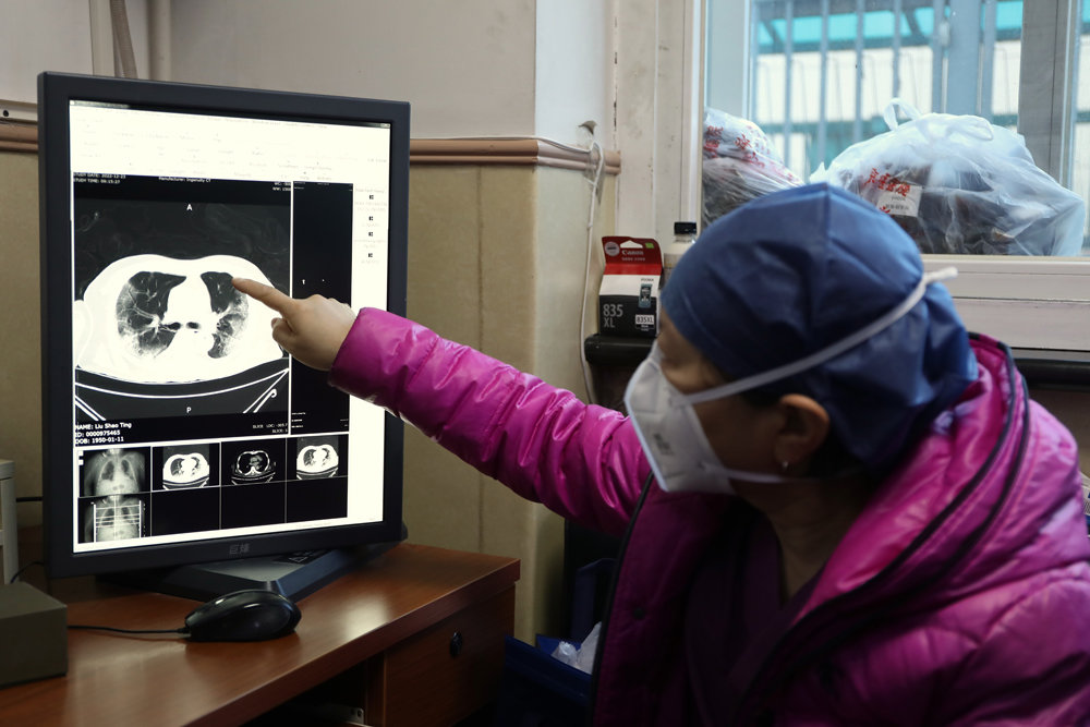 北京中医医院重症医学科宋麦芬主任。图片来源:人民日报健康客户端