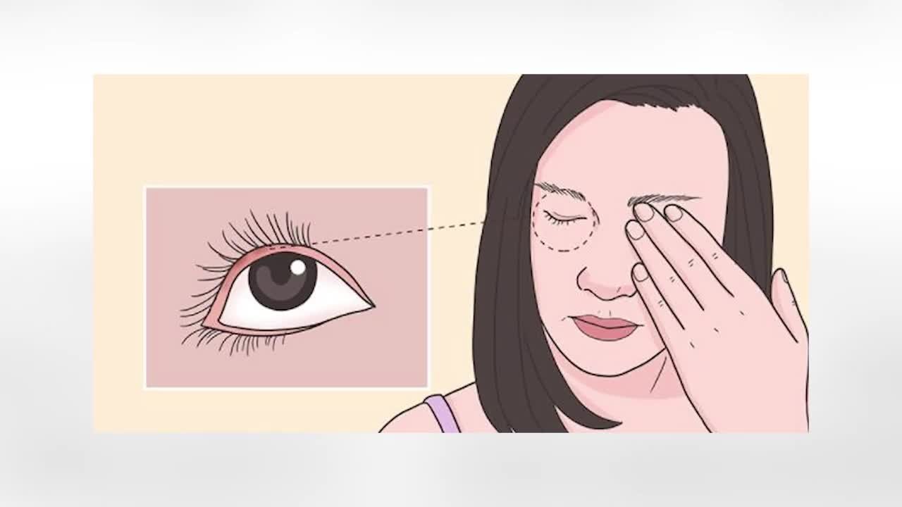 眼病防治中心专家：结膜炎是最常见的新冠病毒眼病