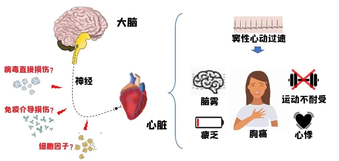 “阳康”后不适的病理生理学机制 | 参考文献[5]
