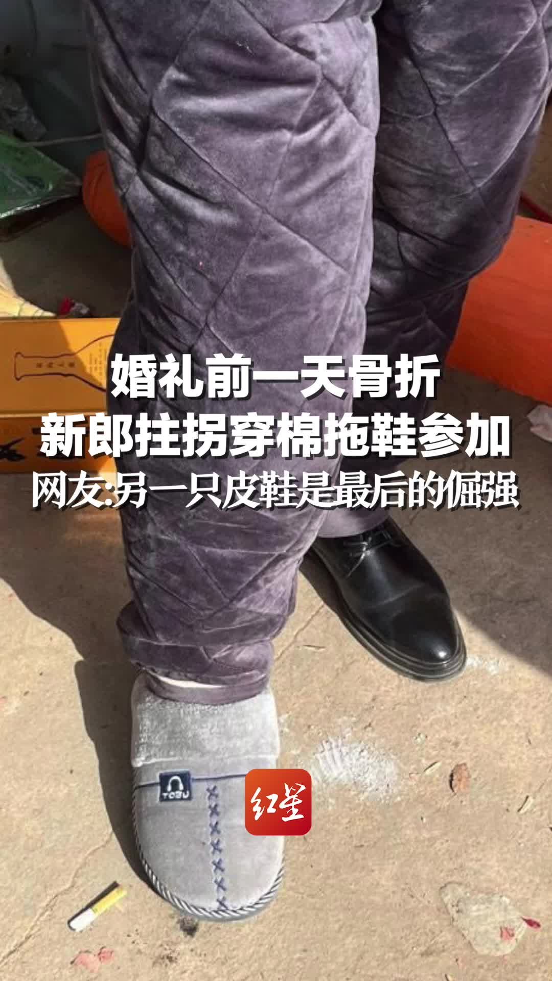 婚礼前一天骨折 新郎拄拐穿棉拖参加，网友：另一只皮鞋是最后的倔强