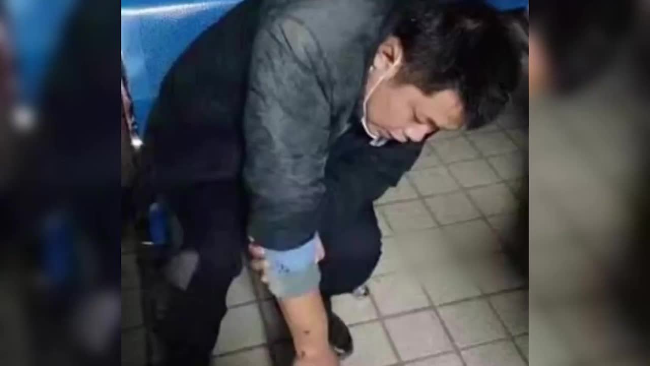 刑警抓捕中骨折，忍痛擒获嫌疑人