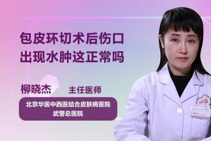 包皮环切术后伤口出现水肿这正常吗