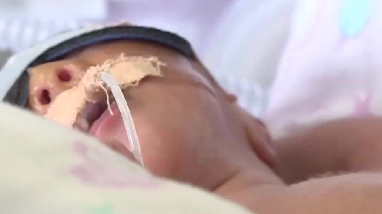 一起渡难关！早产双胞胎姐妹出生后紧紧牵手_凤凰网视频_凤凰网