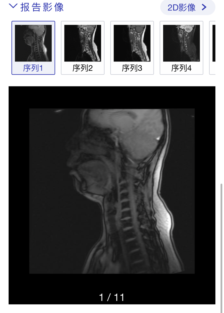 第二步：在报告界面可查看报告和影像（含原(20683301)-20230306153437.png