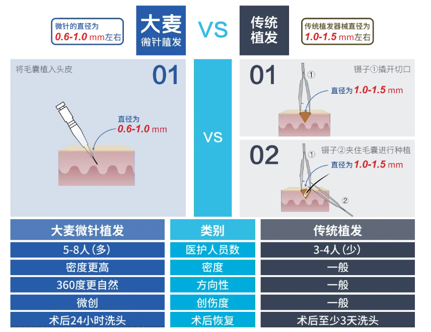 微针植发技术图片