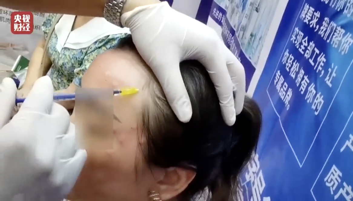 △顾客的脸上布满了鼓包