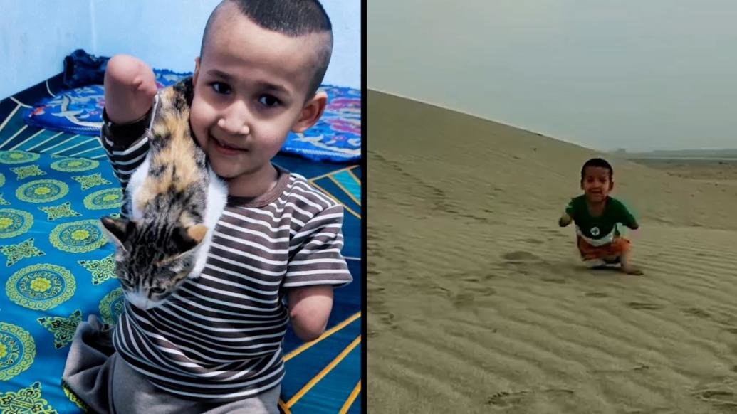 新疆残疾男孩在沙漠里奔跑：天生没有四肢，但我快乐