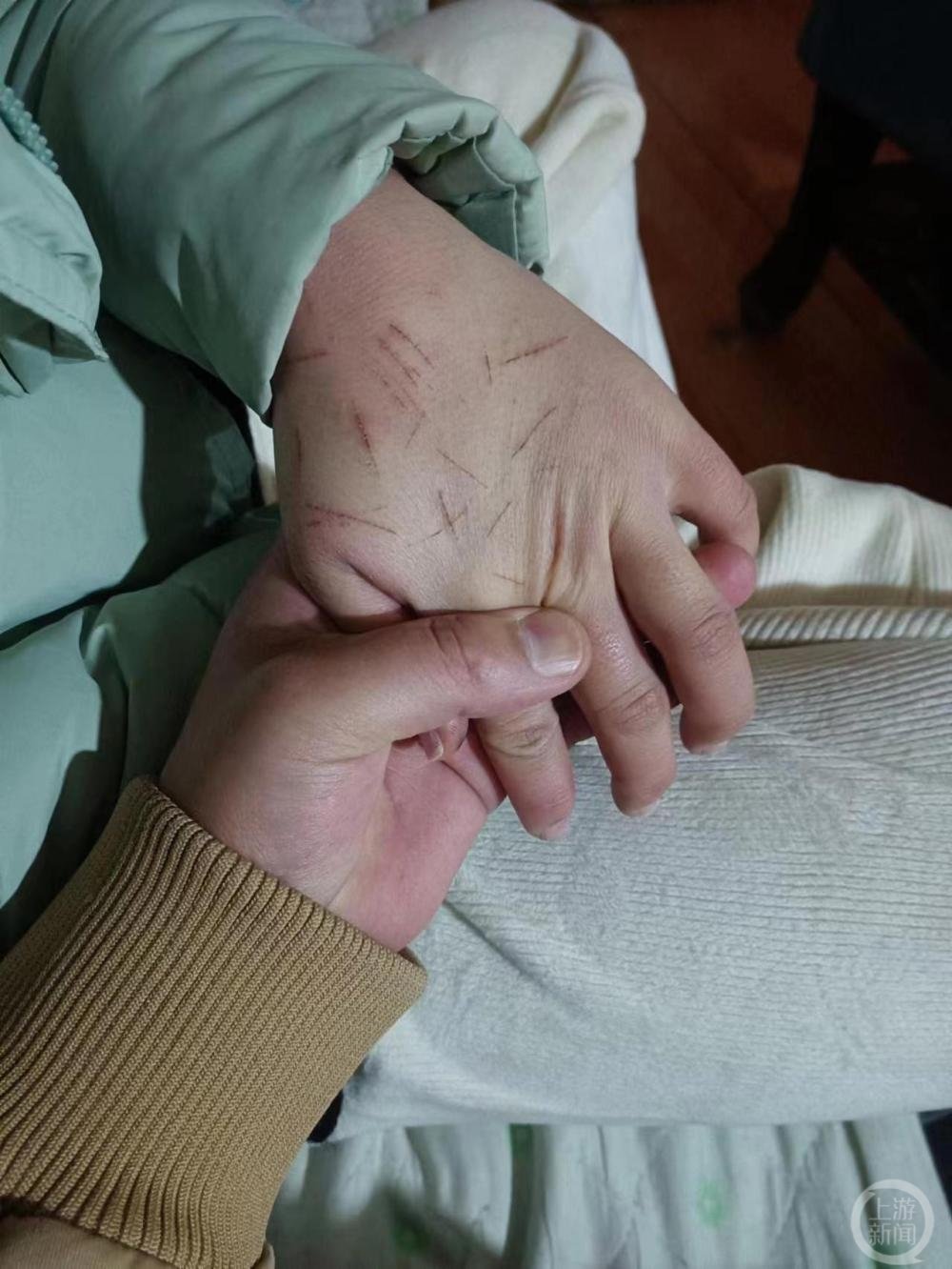 ▲事发已经过去一年多，但女孩至今未能走出阴影。图片来源/受访者供图