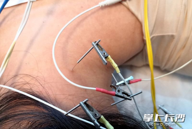 学医从医20多年 他被人称为穿白大褂的活雷锋