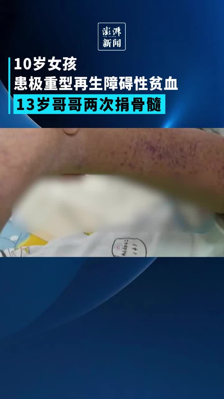 10岁女孩患极重型再生障碍性贫血，哥哥两次捐骨髓