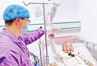 康复治疗师正在给小泽做肢体康复训练。