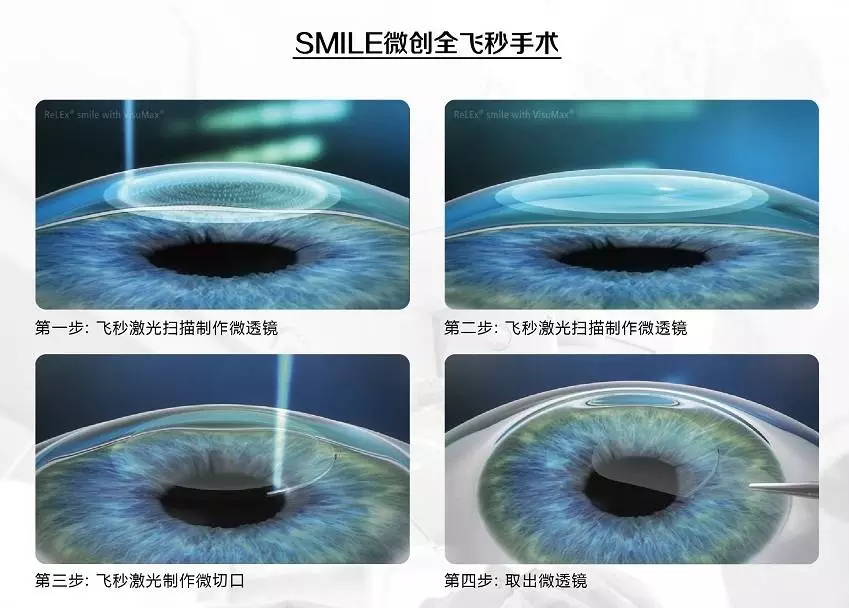 半飞秒和全飞秒区别在哪？哪一个更好？