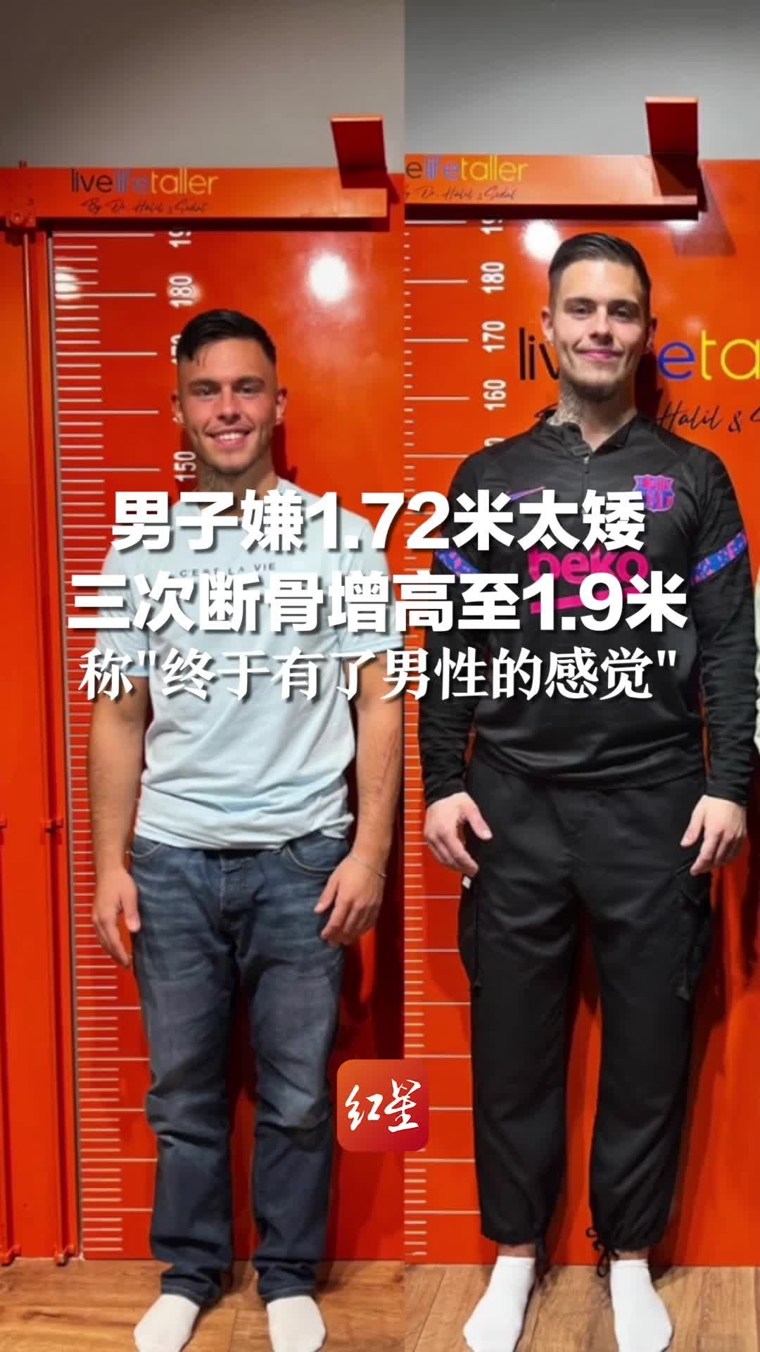 男子嫌1.72米太矮 三次断骨增高至1.9米,称“终于有了男性的感觉”_凤凰网资讯_凤凰网