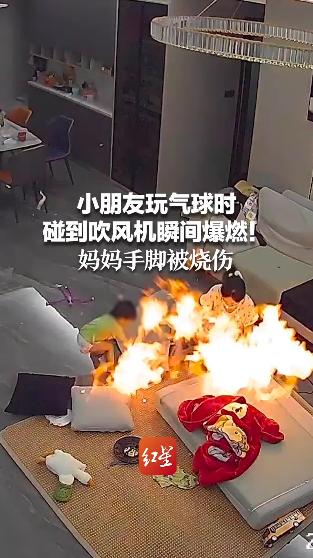 小朋友玩气球时碰到吹风机瞬间爆燃！妈妈手脚被烧伤