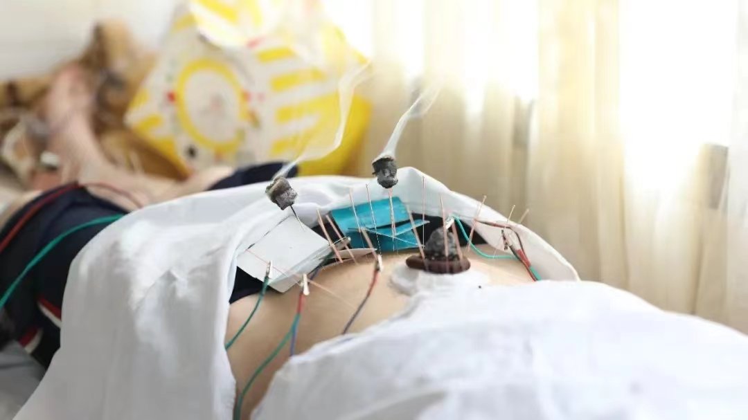 夏至将至冬病夏治正当时