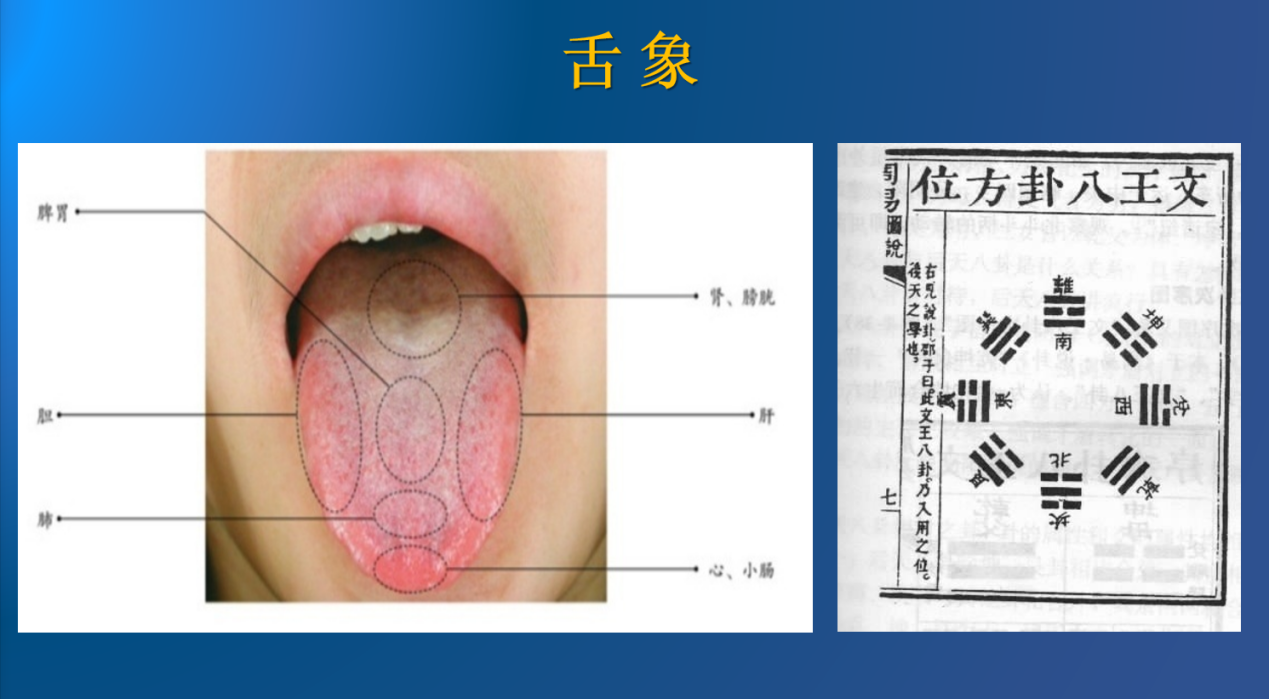 中医所讲的舌象与文王八卦完全一致。