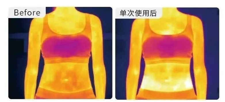 医用腰带怎么戴日本变态“抽脂带”，戴它25分钟≈卷腹368次，再见了啤酒肚_https://www.jmylbn.com_新闻资讯_第11张