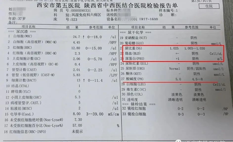 肾结石检查报告图片