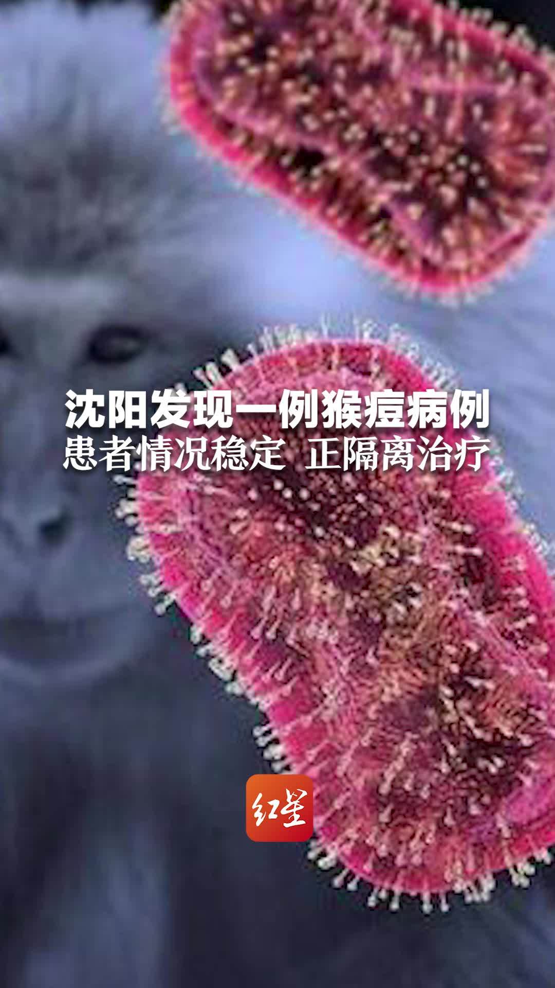 沈阳发现一例猴痘病例 患者情况稳定 正隔离治疗