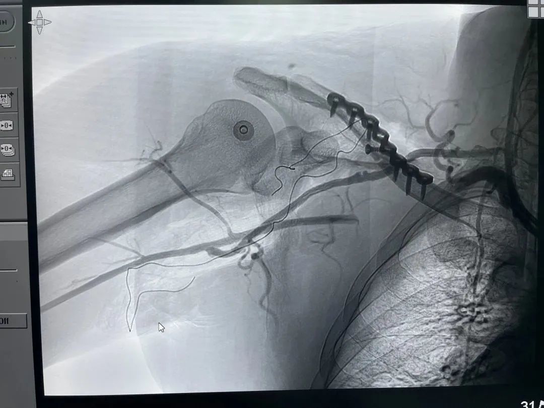 血管接通影像学