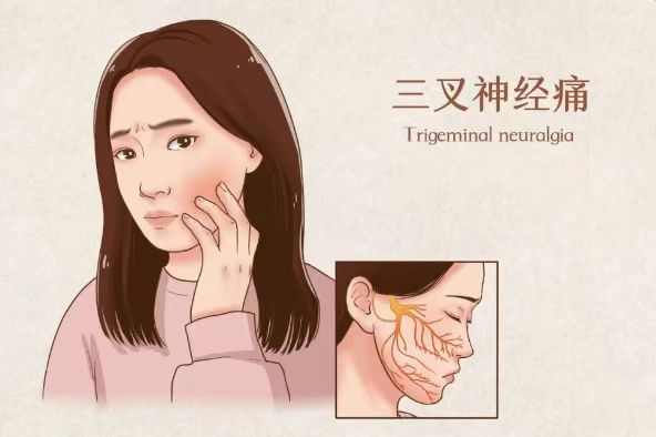 三叉神经疼痛难忍 天道中医创新外治方法缓解疼痛