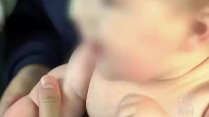 怀疑孩子是“束带综合征”，家长驱车600公里看病，医生：纯粹是胖