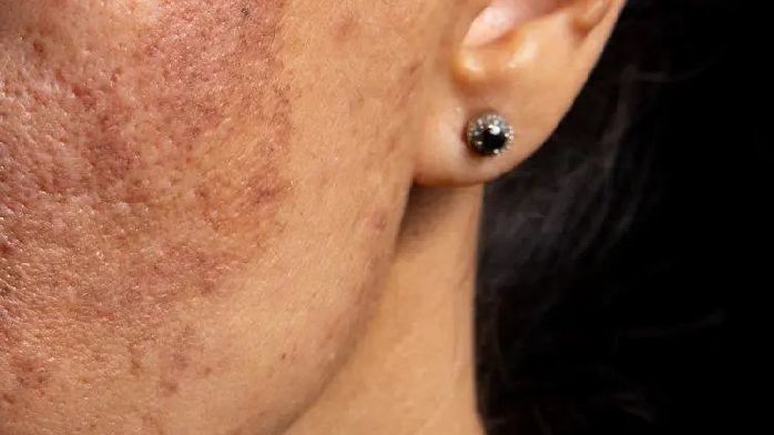 不是皮膚病，而是癌癥預警？皮膚出現3種異常，可能是癌癥來臨
