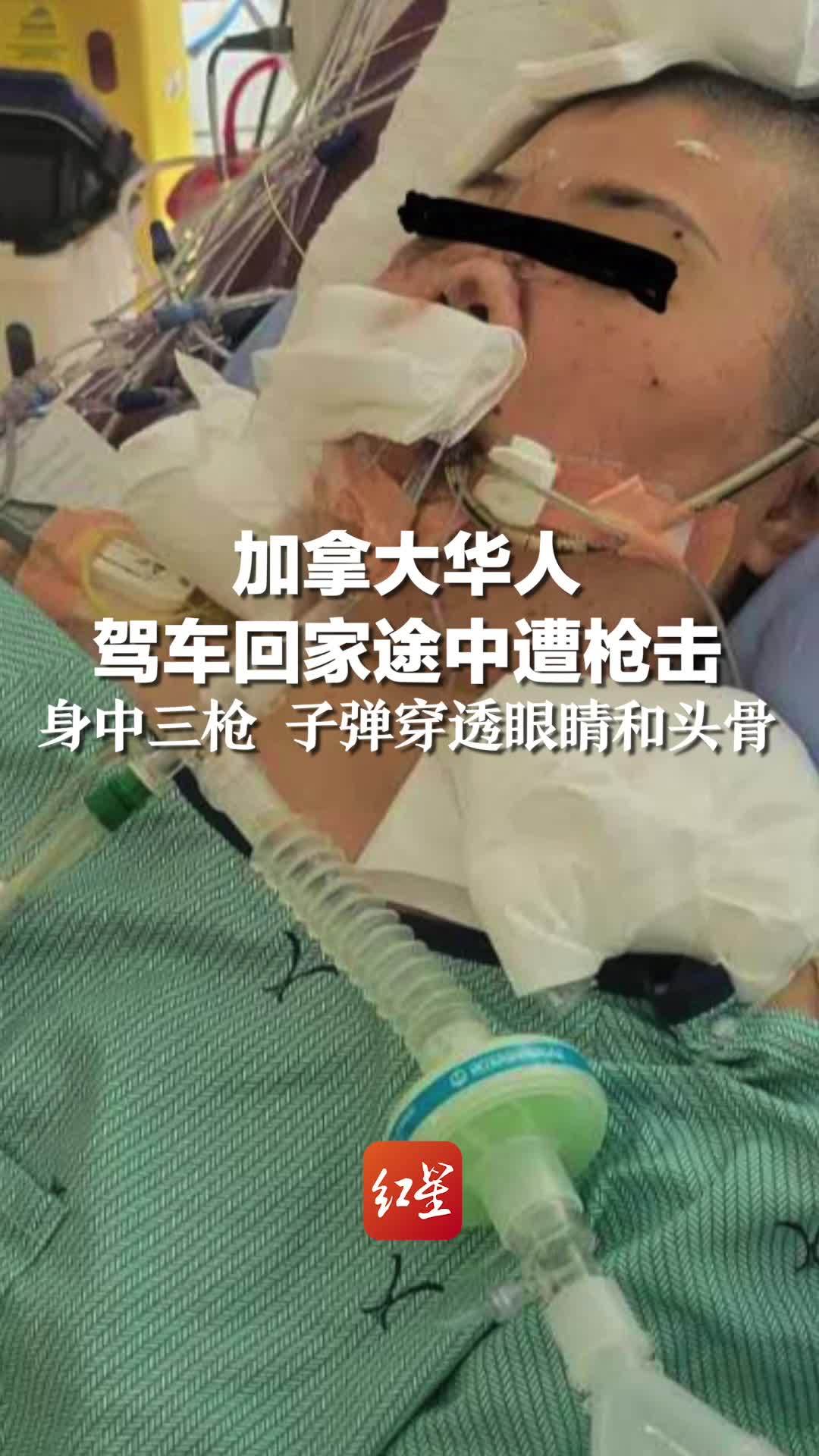 加拿大华人驾车回家途中遭枪击 身中三枪 子弹穿透眼睛和头骨