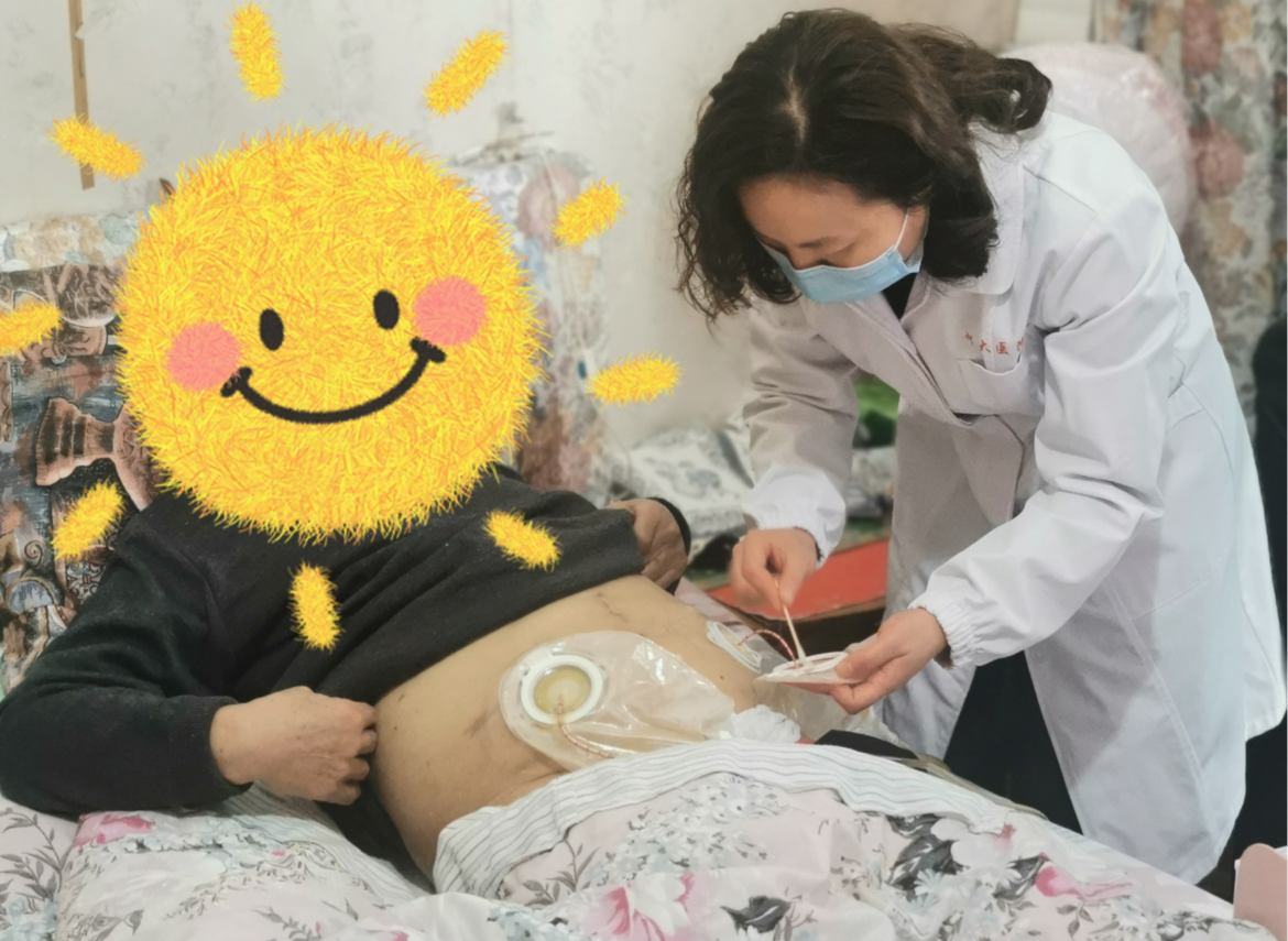 毕护士对李大爷的尿路造口进行清理