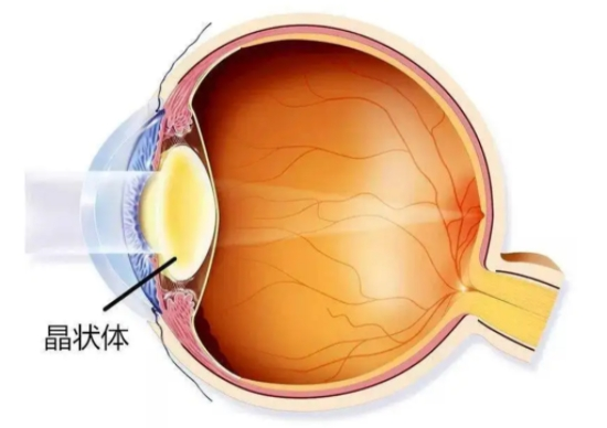 眼球内的晶状体位置示意图