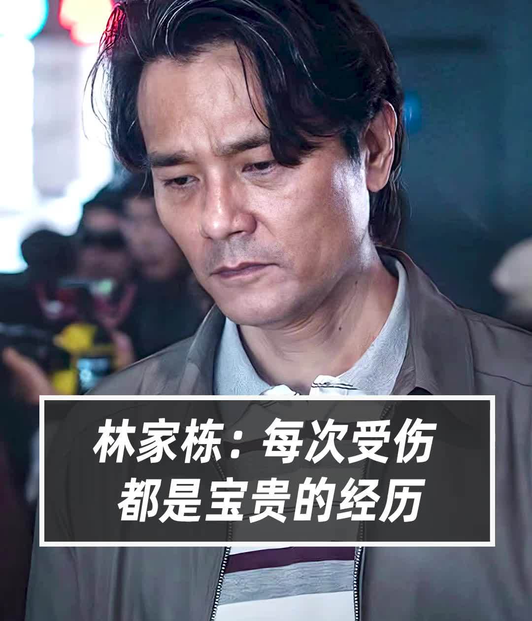 #林家栋不希望拿受伤做卖点 每次受伤，都是演员的宝贵的经历。#林家栋 #当红 #面孔