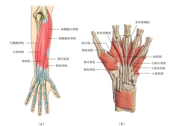 上肢怎么康复生物反馈疗法（EMG）如何运用到偏瘫患者的手功能康复？_https://www.jmylbn.com_新闻资讯_第5张