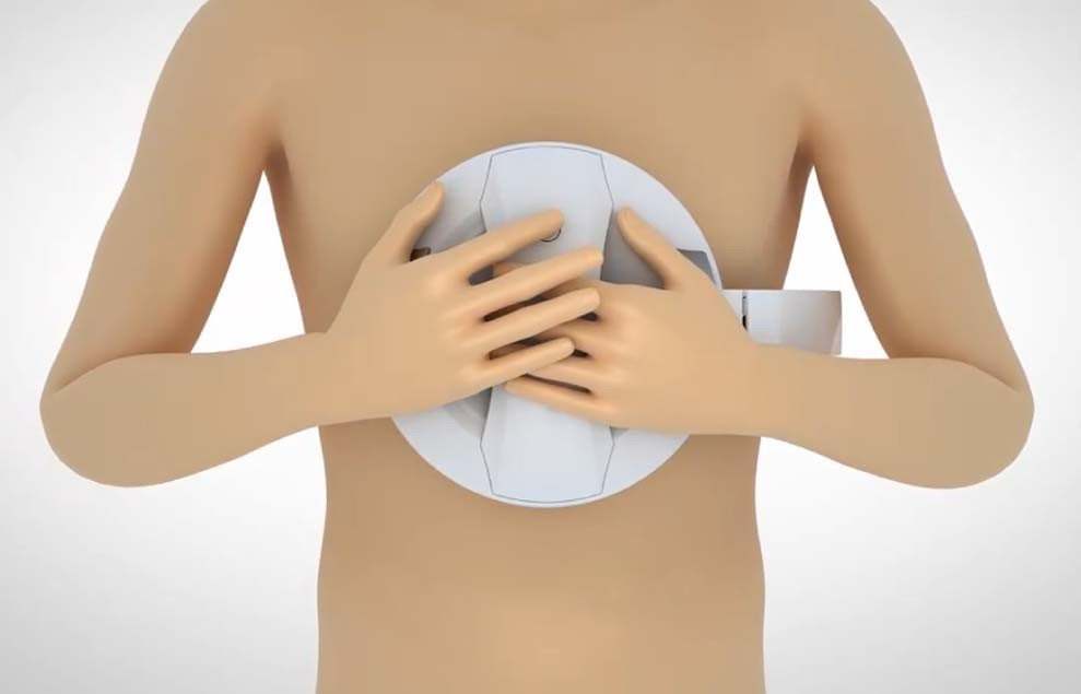 十二导心电图是什么便捷式十二导家用心电仪上市，为何被称为心电监测“黑科技”？_https://www.jmylbn.com_新闻资讯_第2张