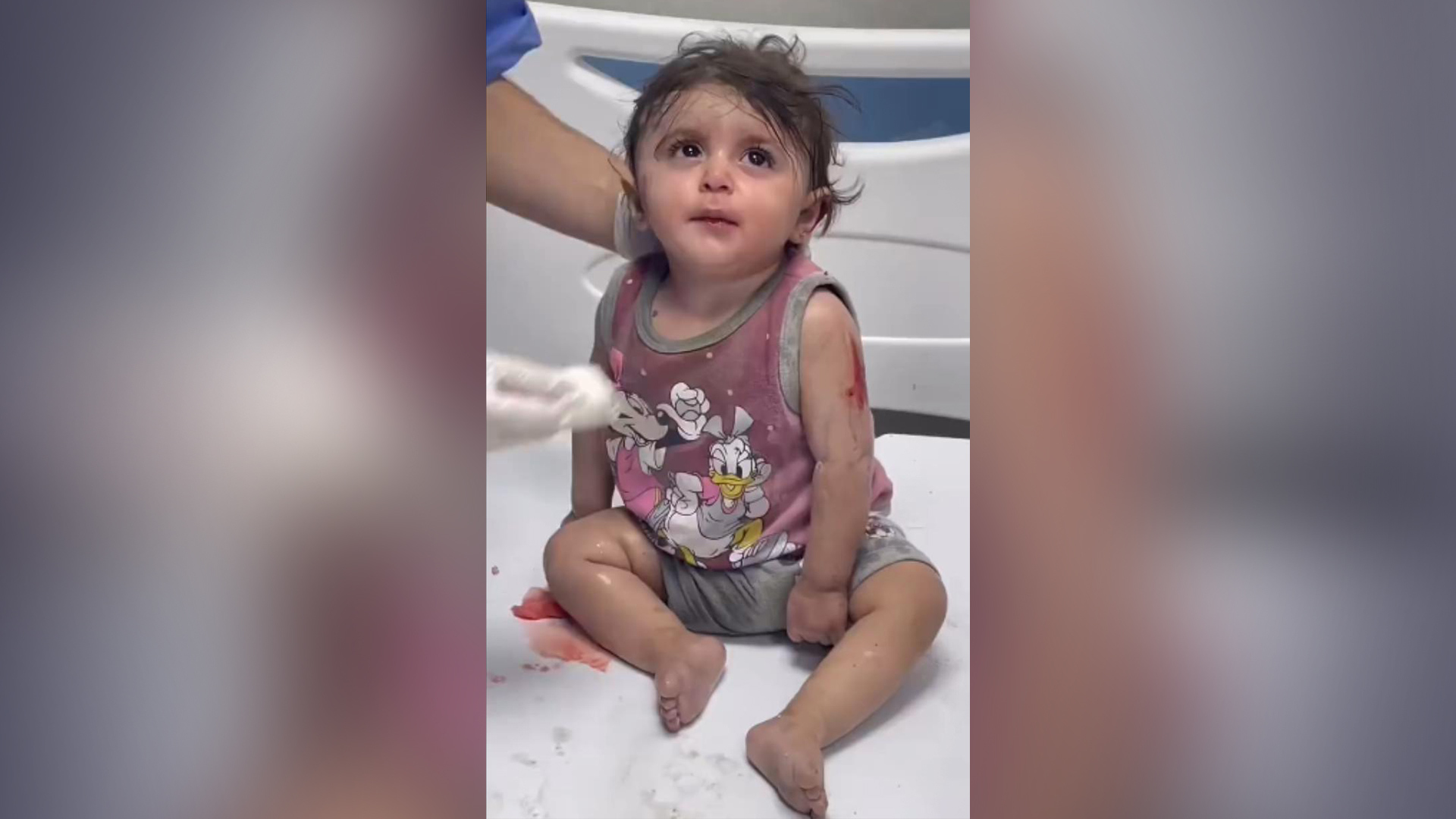 从废墟中被救出的加沙小女孩,眼中充满恐惧,呆呆地看着周围_凤凰网