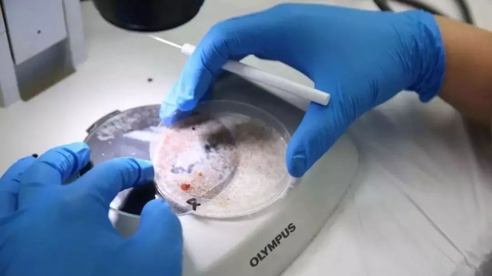 天津出现肺吸虫病例,多人死亡?官方辟谣_凤凰网