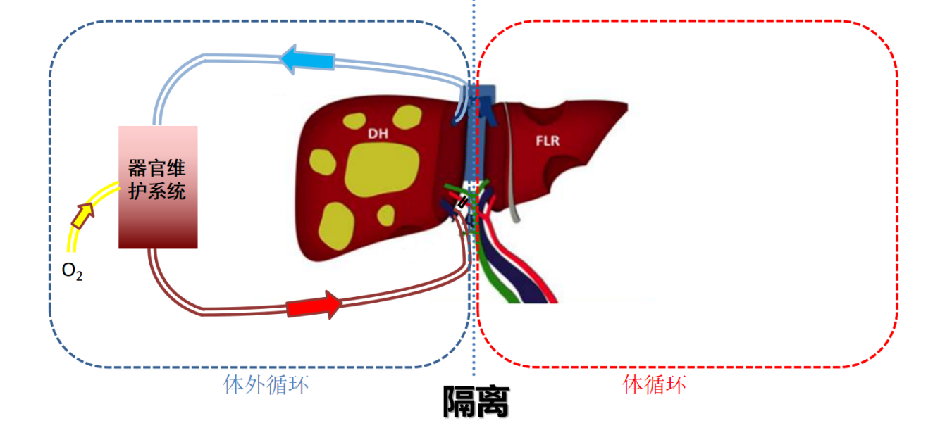 世界首例“肝癌定向治疗术”在中山七院获成功，器官医学研究院同时首创成立