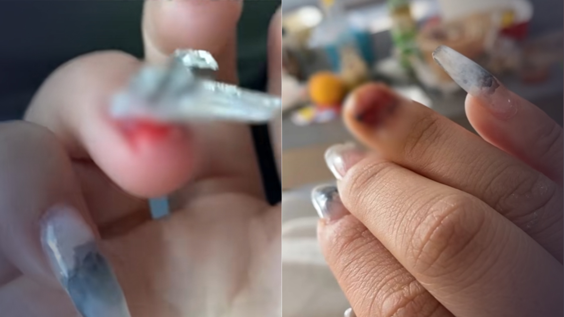 女子上车时不慎坐断美甲整个指甲盖被掀翻