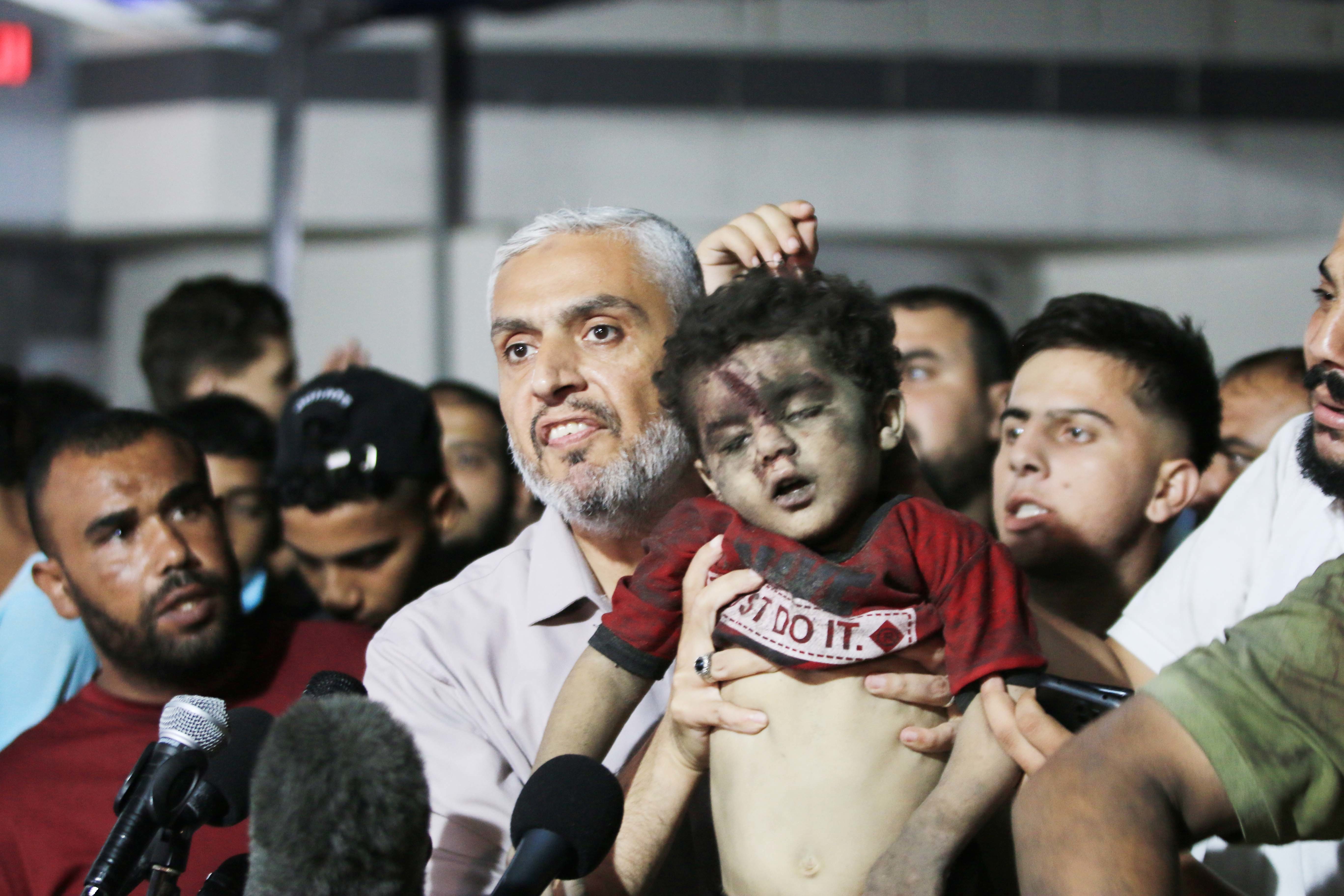 受伤民众被送往希法医院/澎湃影像尽管面临着国际社会越来越大的压力