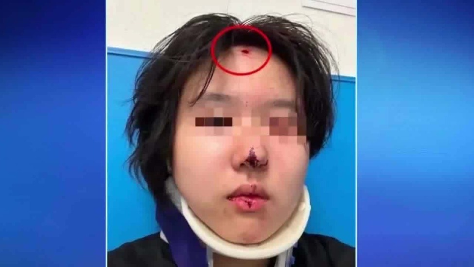 中国留学生洛杉矶街头遭枪击 前额受伤