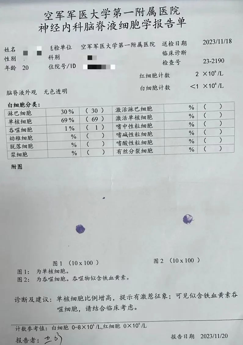 當狼瘡遇上噬血西安市第五醫院陝西省中西醫結合醫院風溼免疫科五病區